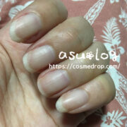 opi_02